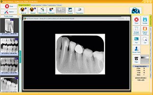 Fona ScaNeo - цифровой сканер