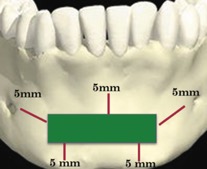 Рисунок 2. Правило трех пятерок.jpg