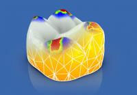 CEREC AC OMNICAM ПРОСТОЕ СКАНИРОВАНИЕ БЕЗ АНТИБЛИКОВОГО СПРЕЯ 14.jpg