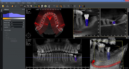 Owandy I-Max Touch 3D Ceph – Конусно-лучевой томограф 9х8
