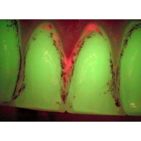 Durr Dental VistaCam IX – интраоральная видеокамера с системой сменных насадок CAM, Proof, Proxi