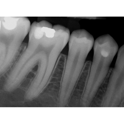 Suni Dr.Suni Plus - система компьютерной радиовизиографии