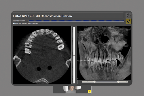 FONA XPan 3D - рентгенографическая цифровая система панорамной съемки