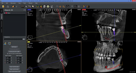 Owandy I-Max Touch 3D – Конусно-лучевой томограф 9х8