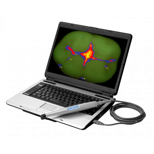 Air Techniques Spectra - оптический детектор кариеса 