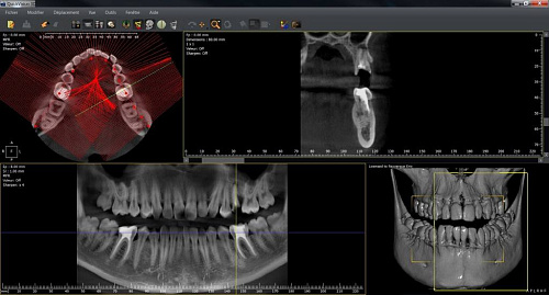 Owandy I-Max Touch 3D – Конусно-лучевой томограф 9х8